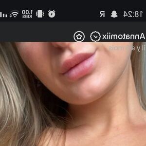 annatomix